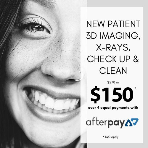 AfterPay available on all treatments at Peninsula Whiter Smiles 🤍 We have  AfterPay available in salon and with our mobile service!…